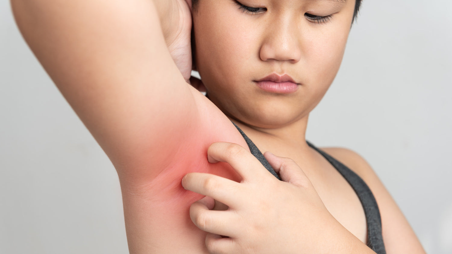 Itching In Armpits? Know These 6 Causes Of Armpit Rashes And Tips